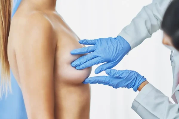 Breast Reconstruction After Cancer