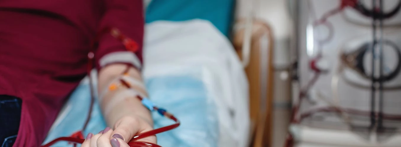 AV Fistula for Dialysis