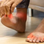 Understanding Diabetic Foot and Why Early Intervention Matters