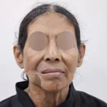 Onco Care