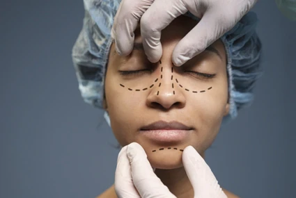 Rhinoplasty