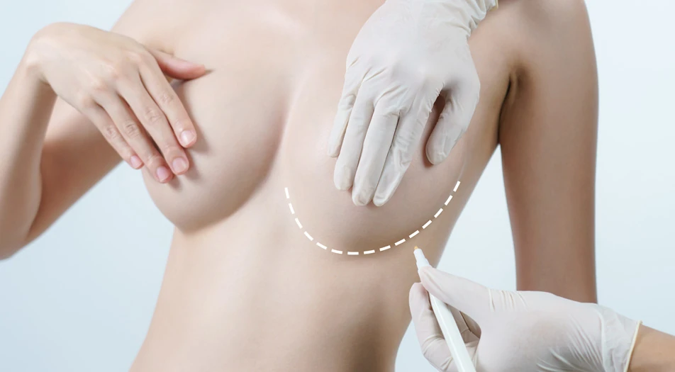 What is Breast Reconstruction after Cancer?