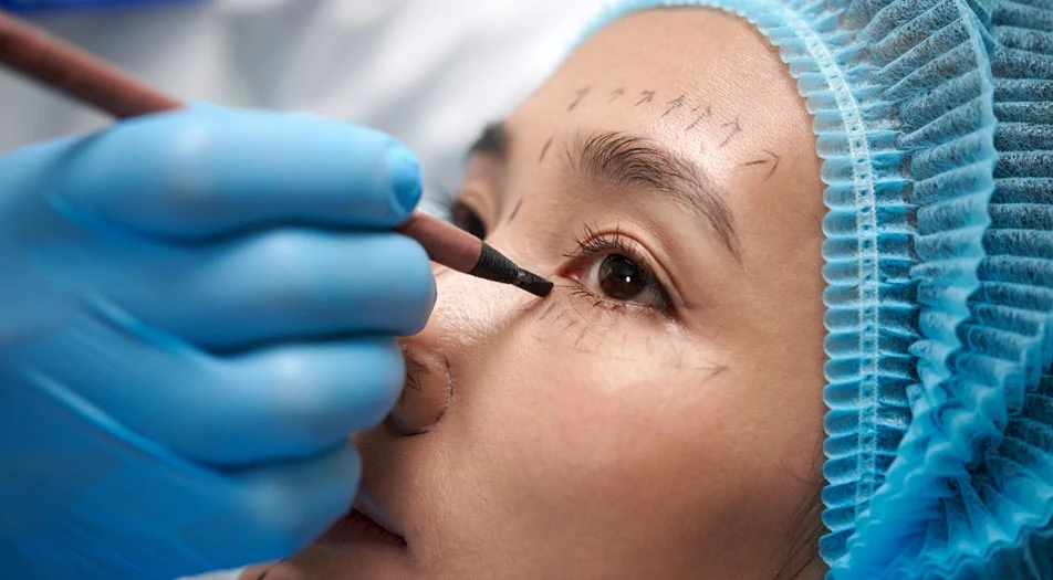 What is Blepharoplasty?