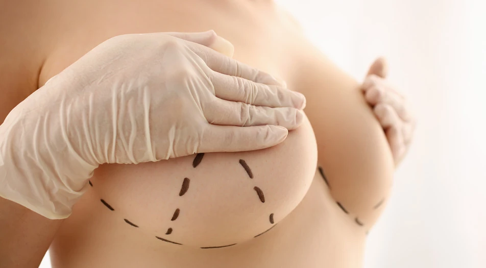 What is Breast Reduction Surgery?