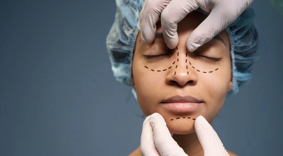 What is Rhinoplasty?